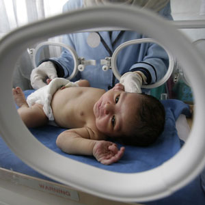 Premature baby photo by Nasser Nouri